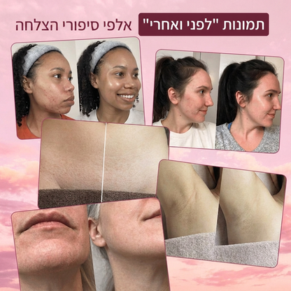 שמן סייפרוס רוטנדום להפחתת צמיחת שיער